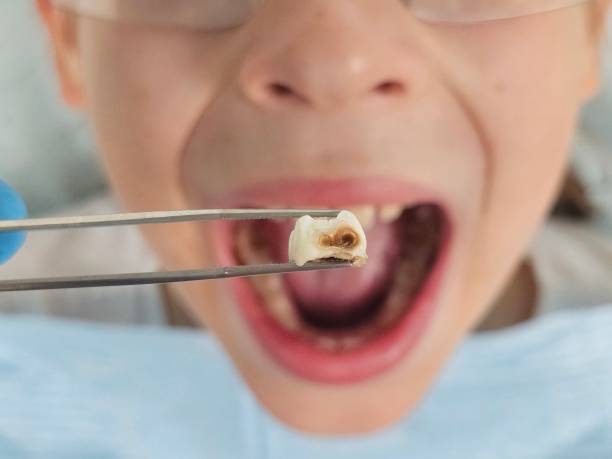 Best Emergency Broken Tooth Repair in Sa Conejo, CA